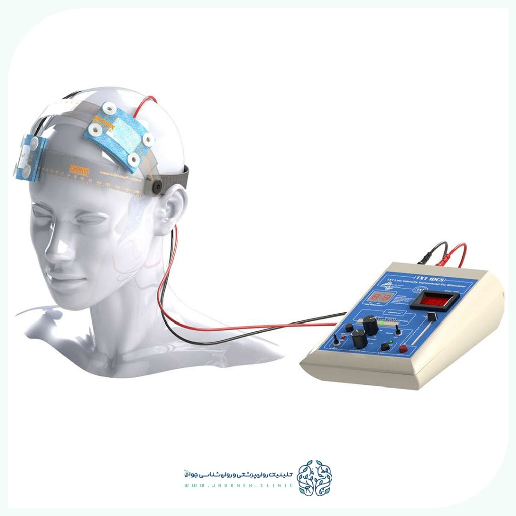 دستگاه TDCS