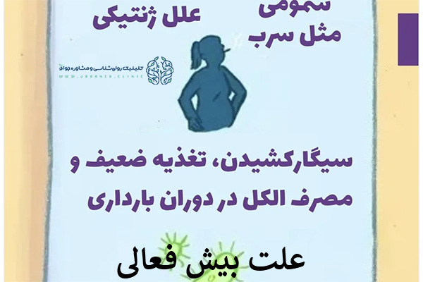 علت بیش فعالی