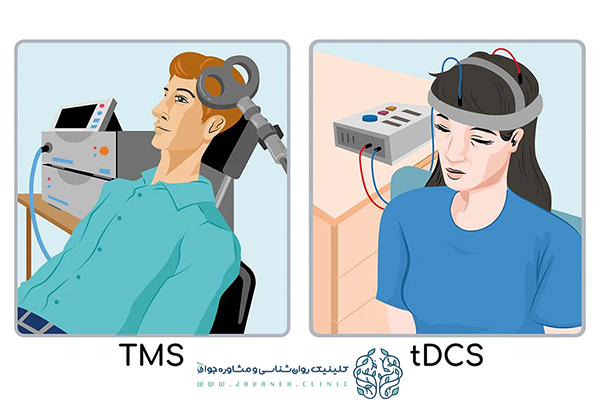 دستگاههای مدرن درمان اختلال شخصیت مرزی: اثربخشی و آرامش در کلینیک جوانه 5 درمان اختلال شخصیت مرزی