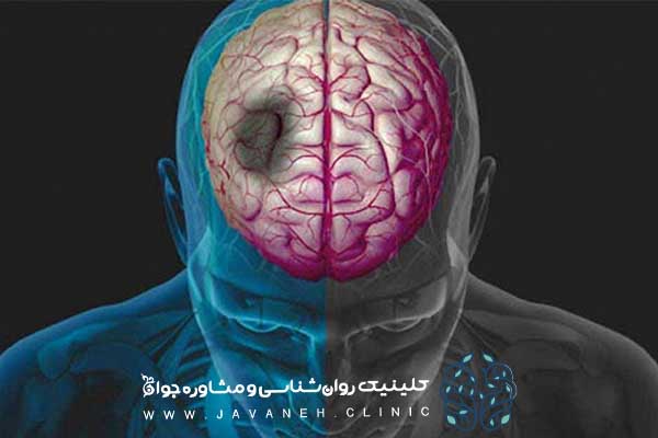 عوارض بی خوابی بر مغز و سایر اعضای بدن (بهترین درمان کم خوابی) 2 عوارض بی خوابی بر مغز